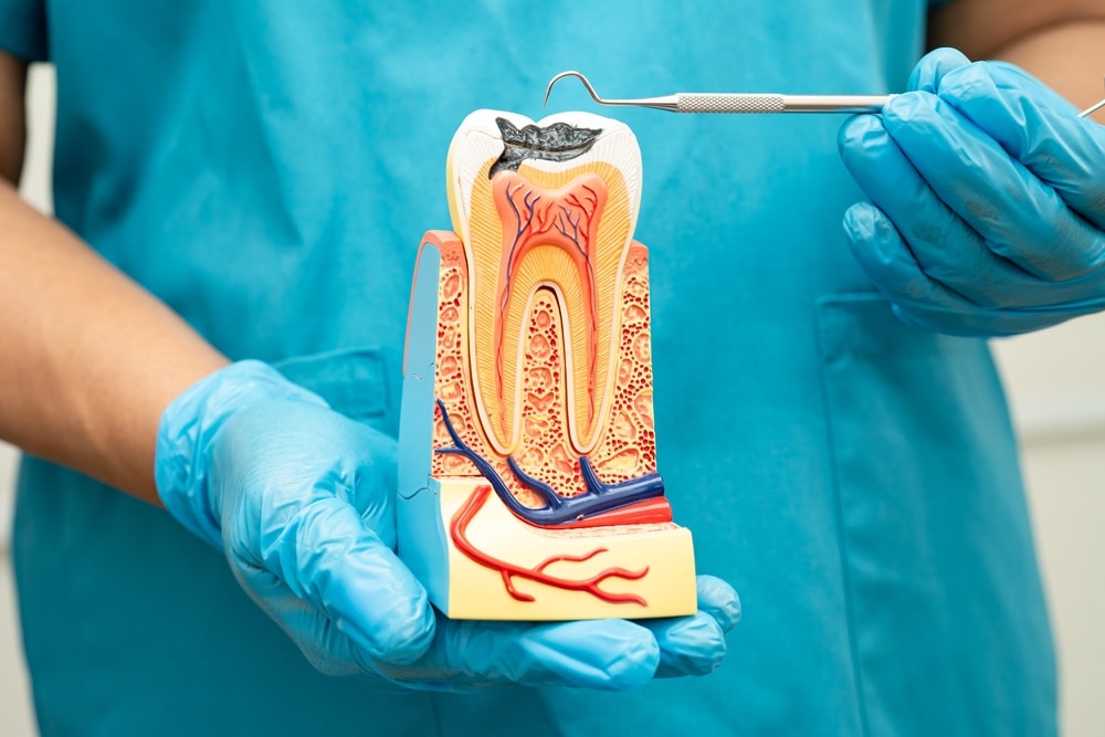 root canal cost with insurance