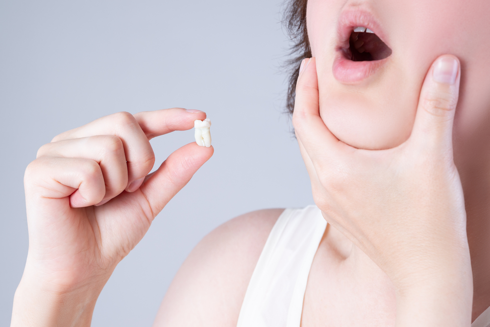 dentist for wisdom teeth extraction